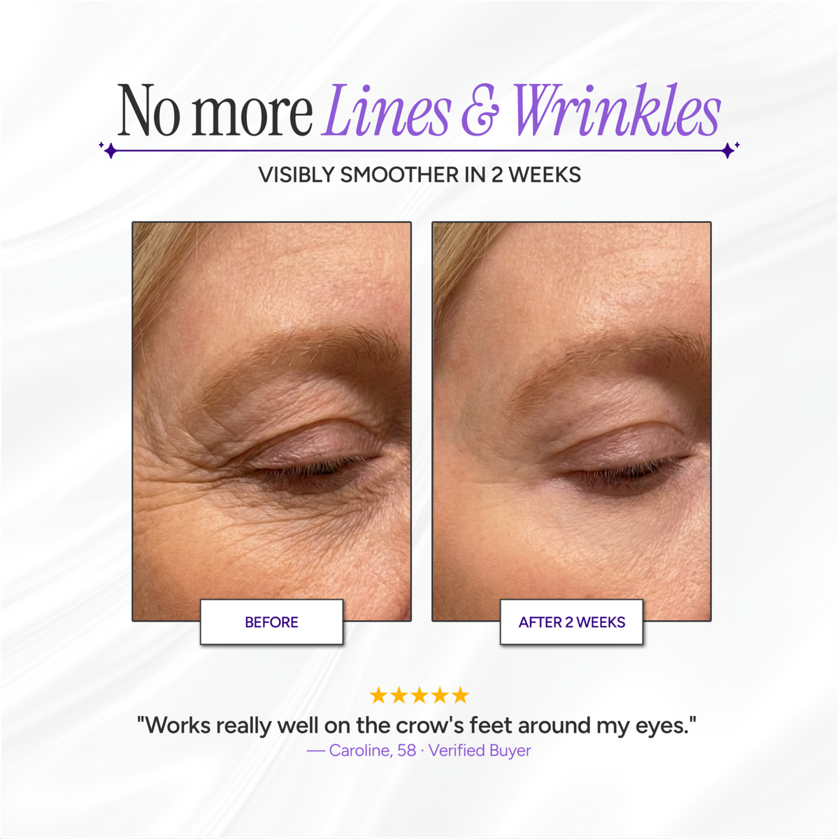 Scarlette™ Silicone Collagen Sheets-NEW: 🏆 2026 RATED SKINCARE INNOVATION FOR WRINKLES