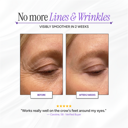 Scarlette™ Silicone Collagen Sheets-NEW: 🏆 2026 RATED SKINCARE INNOVATION FOR WRINKLES