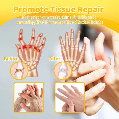 BeeRx BeeThera | Bee Venom-Infused Relief for Bones & Joints