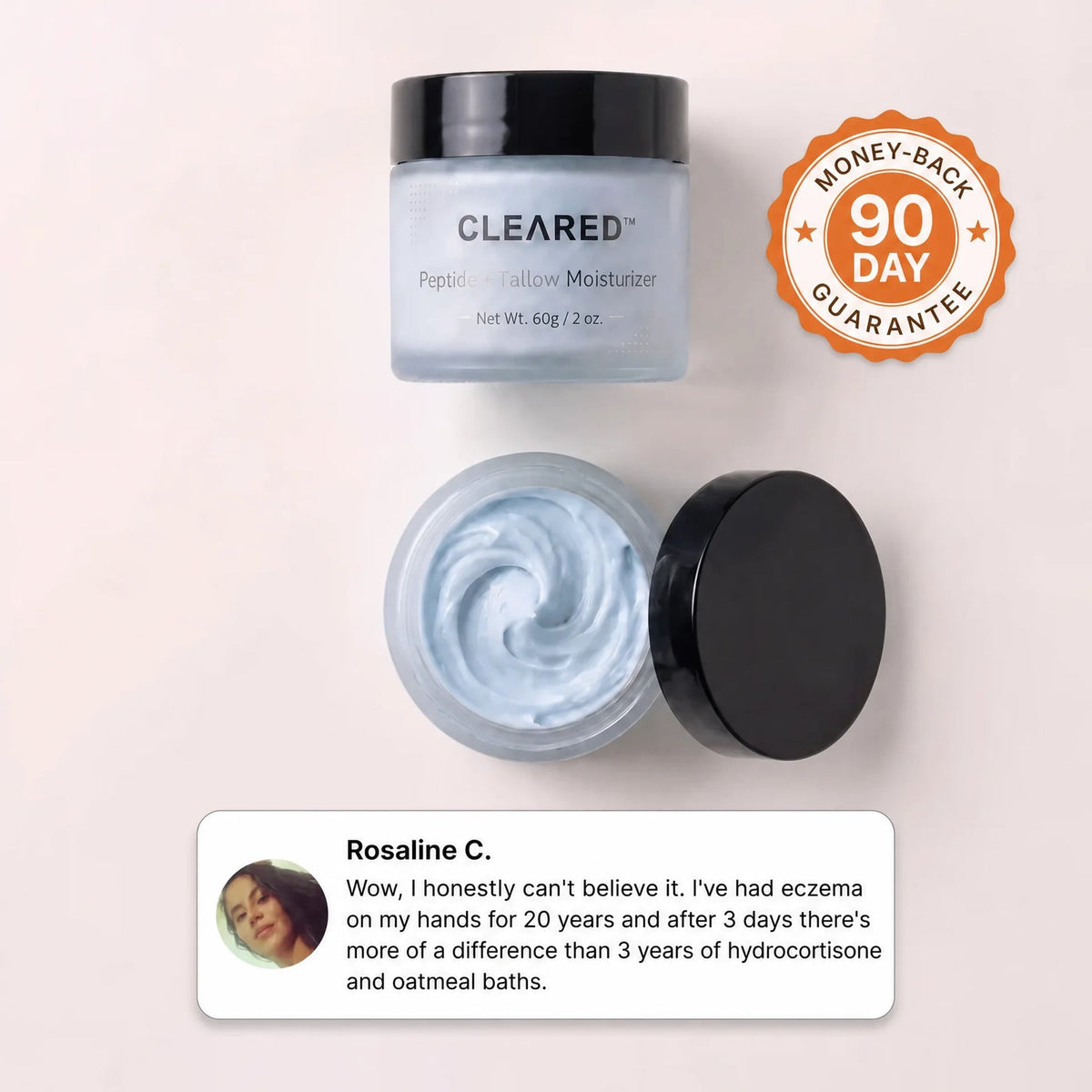 Whipped Tallow Barrier Cream for Eczema Prone Skin