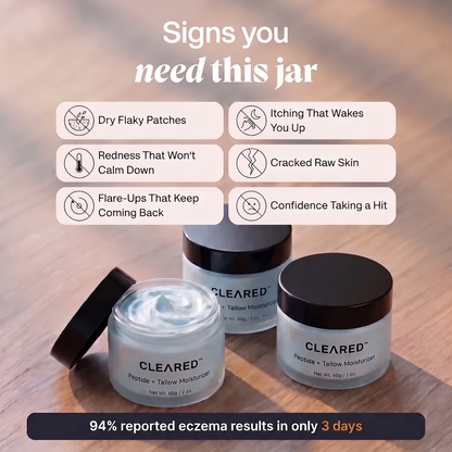 Whipped Tallow Barrier Cream for Eczema Prone Skin