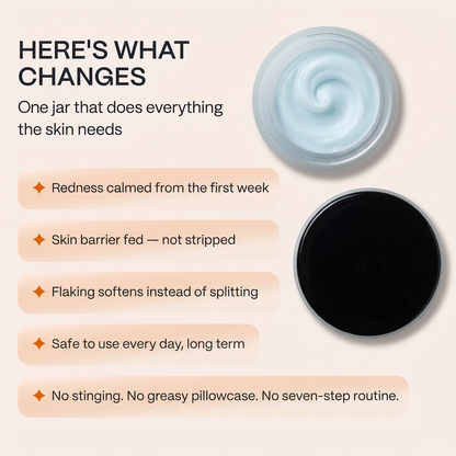 Whipped Tallow Barrier Cream for Eczema Prone Skin