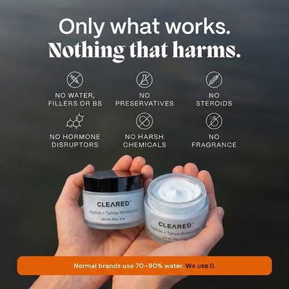Whipped Tallow Barrier Cream for Eczema Prone Skin