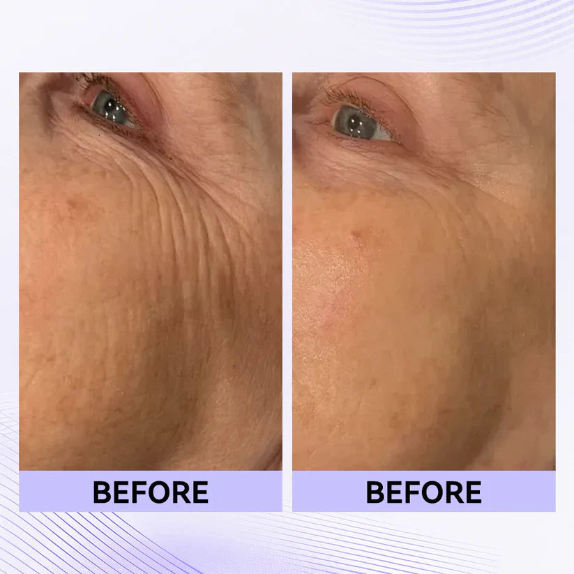Eye Tightener - Skin Firming Cream