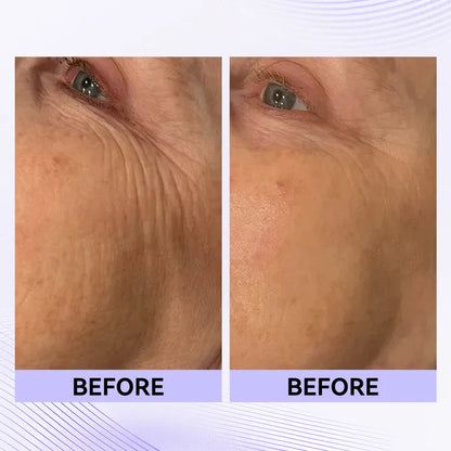 Eye Tightener - Skin Firming Cream
