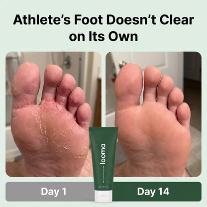 LIMETOW® Antifungal Barrier Cream