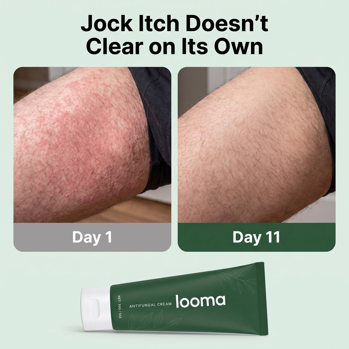 LIMETOW® Antifungal Barrier Cream