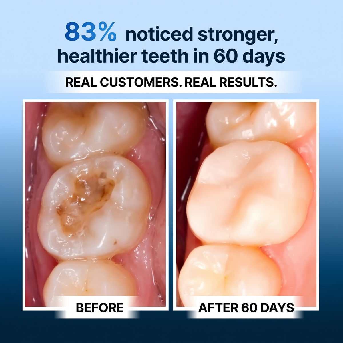 Oxyteeth Enamel Remineralization Drops