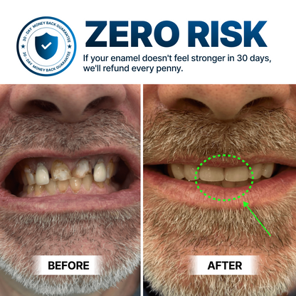 Oxyteeth Enamel Remineralization Drops