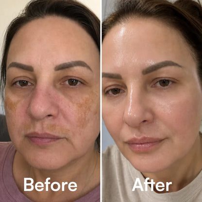 The mask that gives you even-toned skin