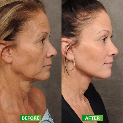 LIMETOW® Vita A Retinol Shot Cream