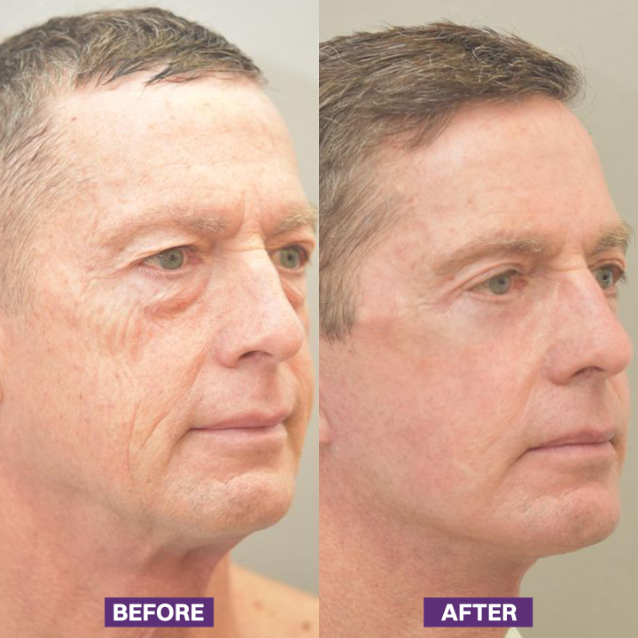LIMETOW® Eye Bag Firming Cream