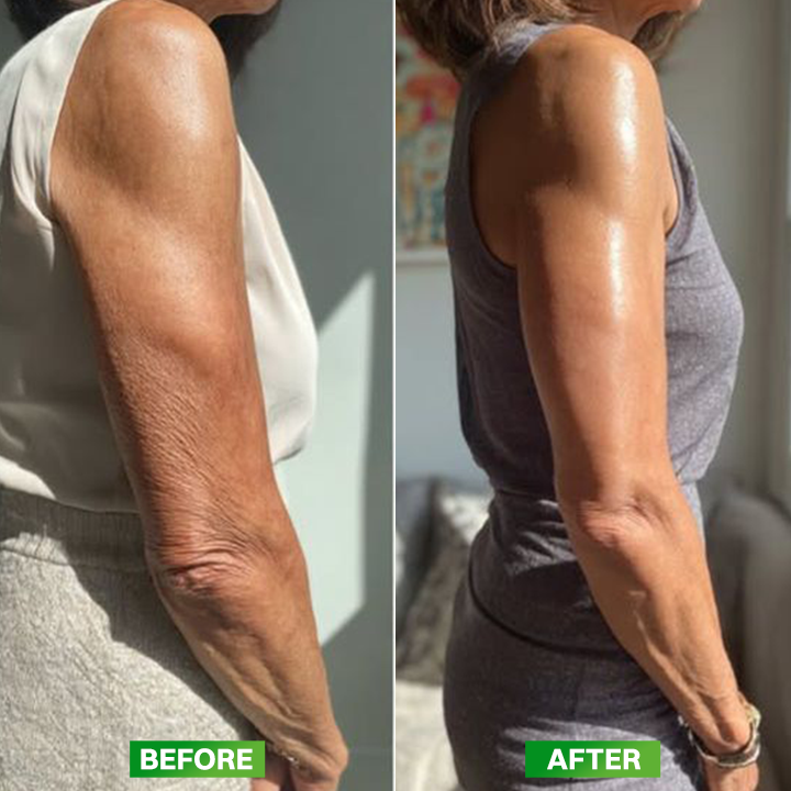 LIMETOW® Vita A Retinol Shot Cream
