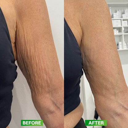 LIMETOW® Vita A Retinol Shot Cream