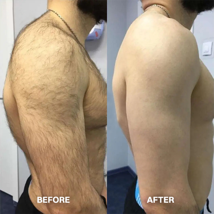 LIMETOW® Hair Removal Cream for All Women & Men