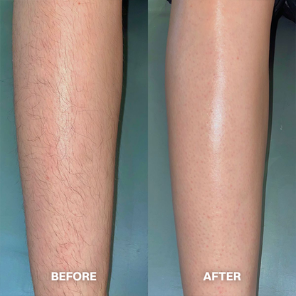 LIMETOW® Hair Removal Cream for All Women & Men