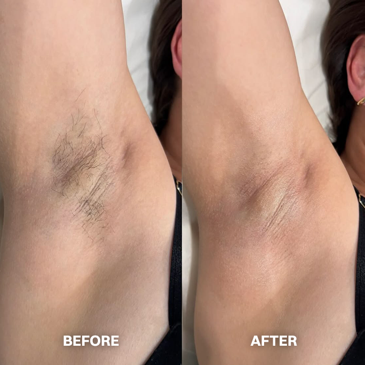 LIMETOW® Hair Removal Cream for All Women & Men