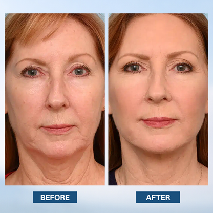 LIMETOW® Facelift Serum