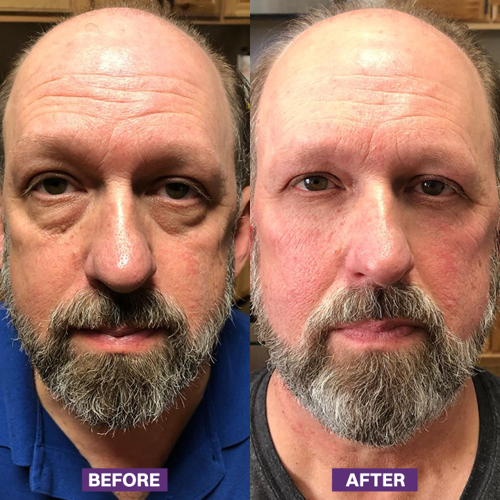 LIMETOW® Eye Bag Firming Cream