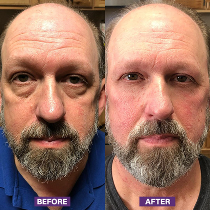 LIMETOW® Eye Bag Firming Cream