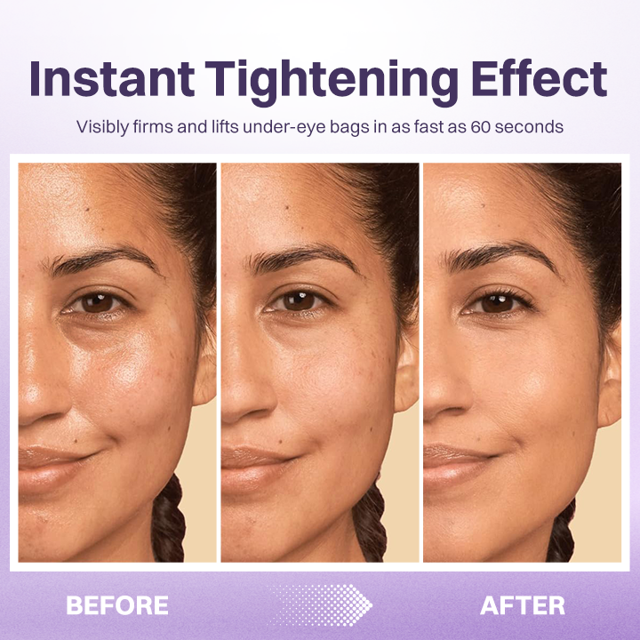 LIMETOW® Eye Bag Firming Cream