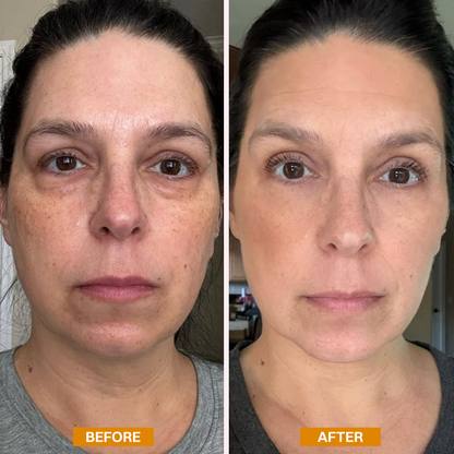 LIMETOW® Retinol Eyebag Cream