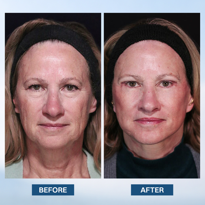 LIMETOW® Facelift Serum