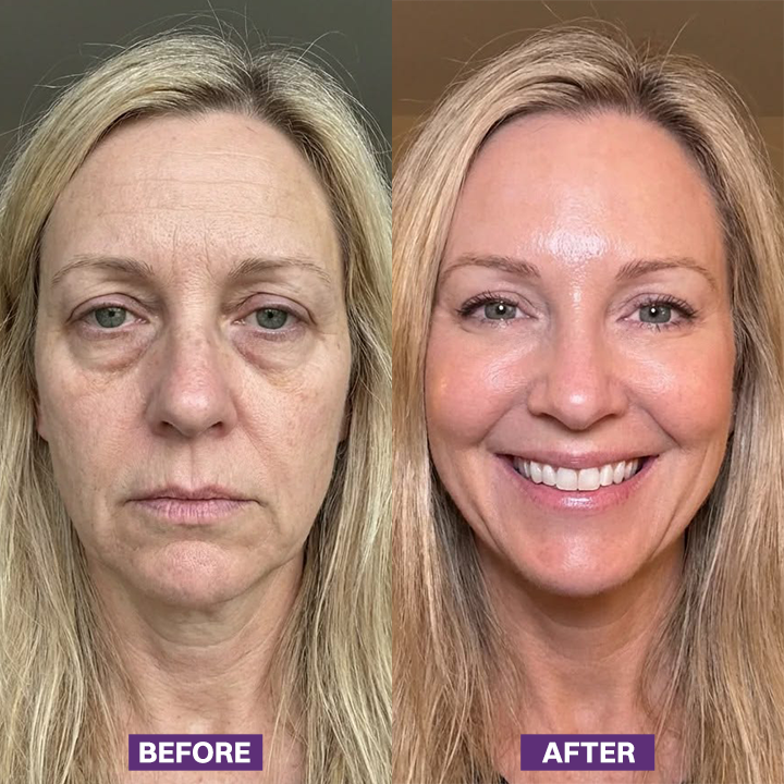 LIMETOW® Eye Bag Firming Cream