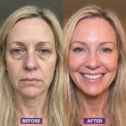 LIMETOW® Eye Bag Firming Cream