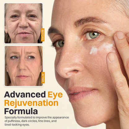 LIMETOW® Retinol Eyebag Cream