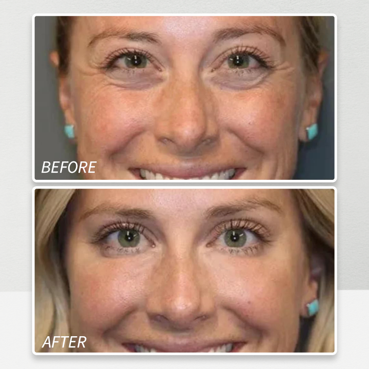 LIMETOW™🔥 Instant Eye Cream Tightener 🔥