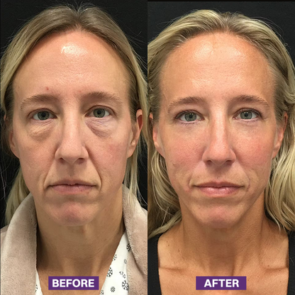 LIMETOW® Eye Bag Firming Cream