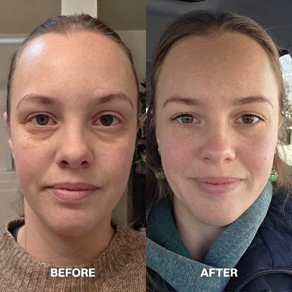 LIMETOW® Peptide Eye Serum VS. TRADITIONAL OPTIONS