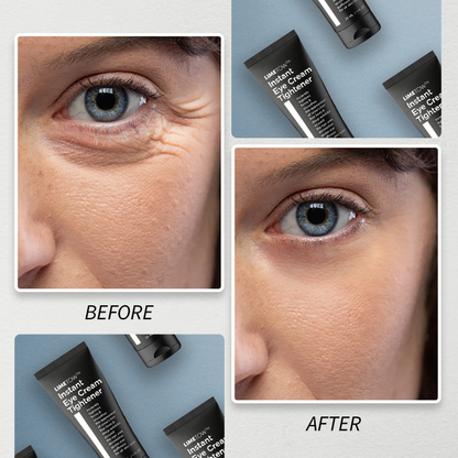 LIMETOW™🔥 Instant Eye Cream Tightener 🔥