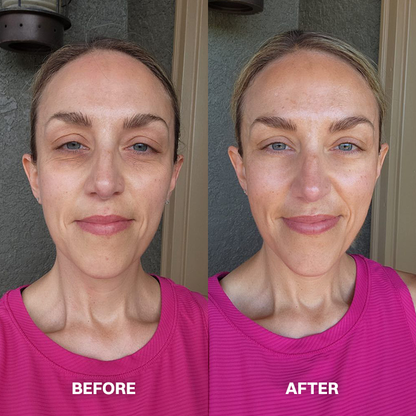 LIMETOW® Scar Removal Cream