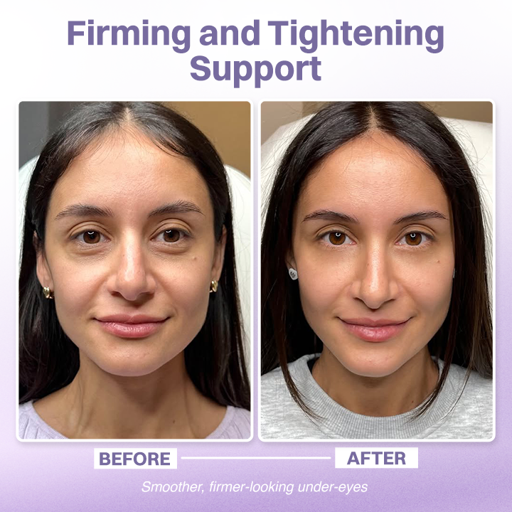 LIMETOW® Eye Bag Firming Cream