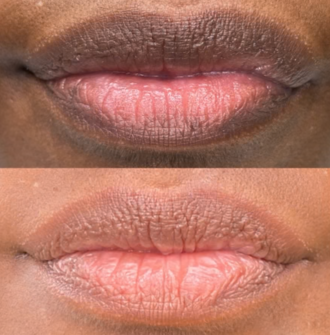 LIMETOW® Dark Lips Brightening Cream