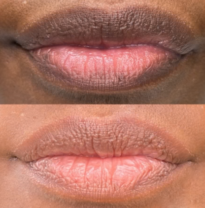 LIMETOW® Dark Lips Brightening Cream