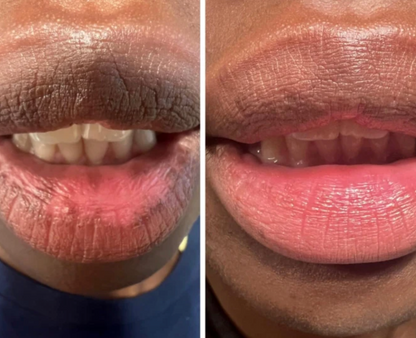 LIMETOW® Dark Lips Brightening Cream