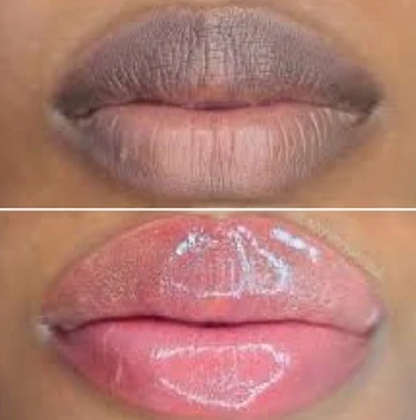 LIMETOW® Dark Lips Brightening Cream