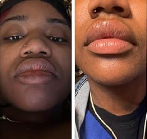 LIMETOW® Dark Lips Brightening Cream