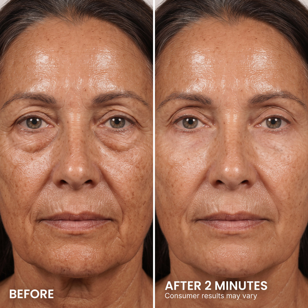 LIMETOW® Instant Eye Tightener