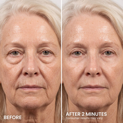 LIMETOW® Instant Eye Tightener