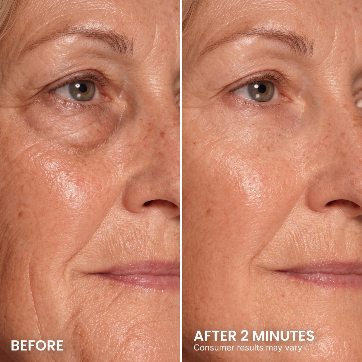 LIMETOW® Instant Eye Tightener