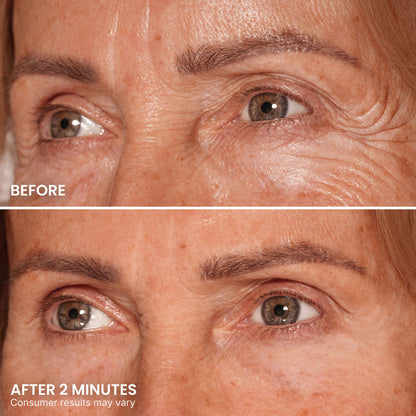 LIMETOW® Instant Eye Tightener