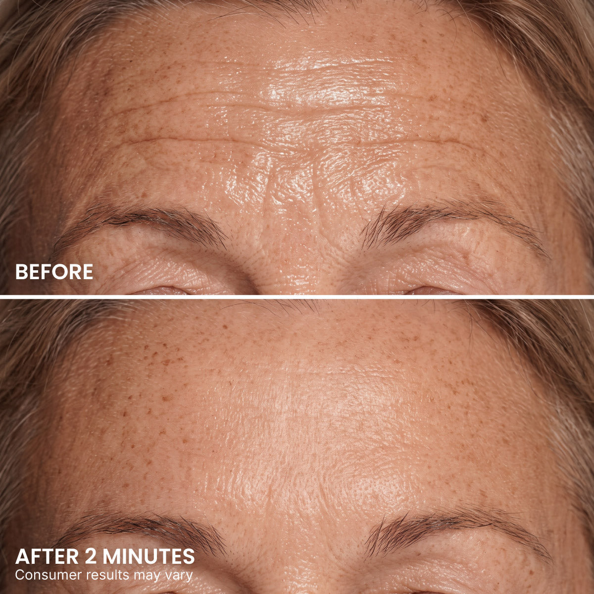 LIMETOW® Instant Eye Tightener