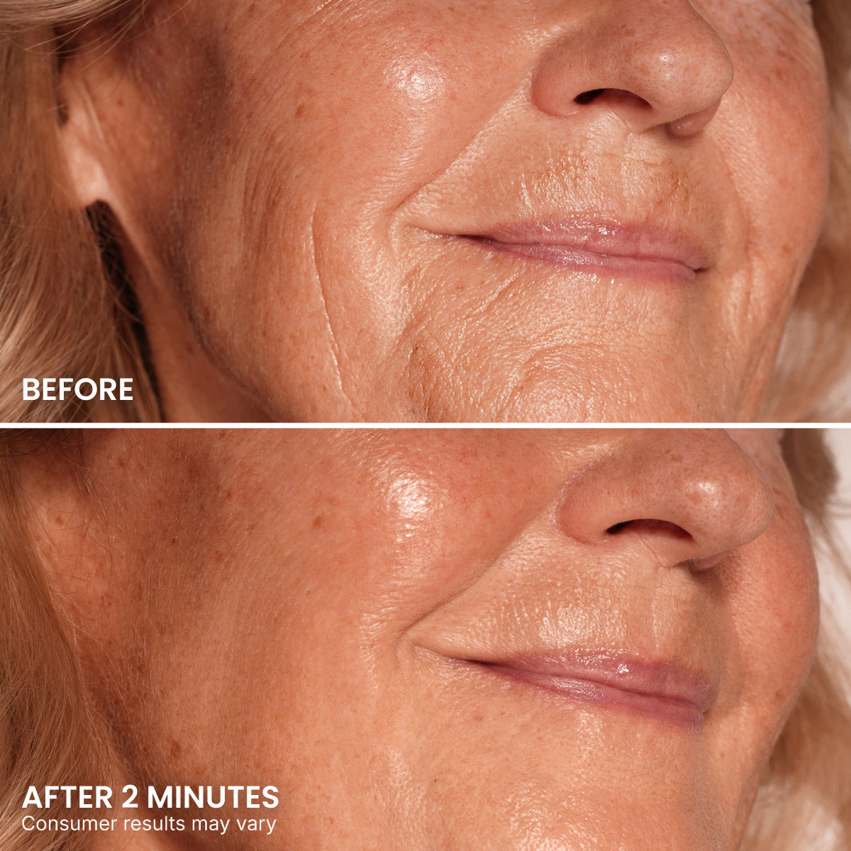 LIMETOW® Instant Eye Tightener