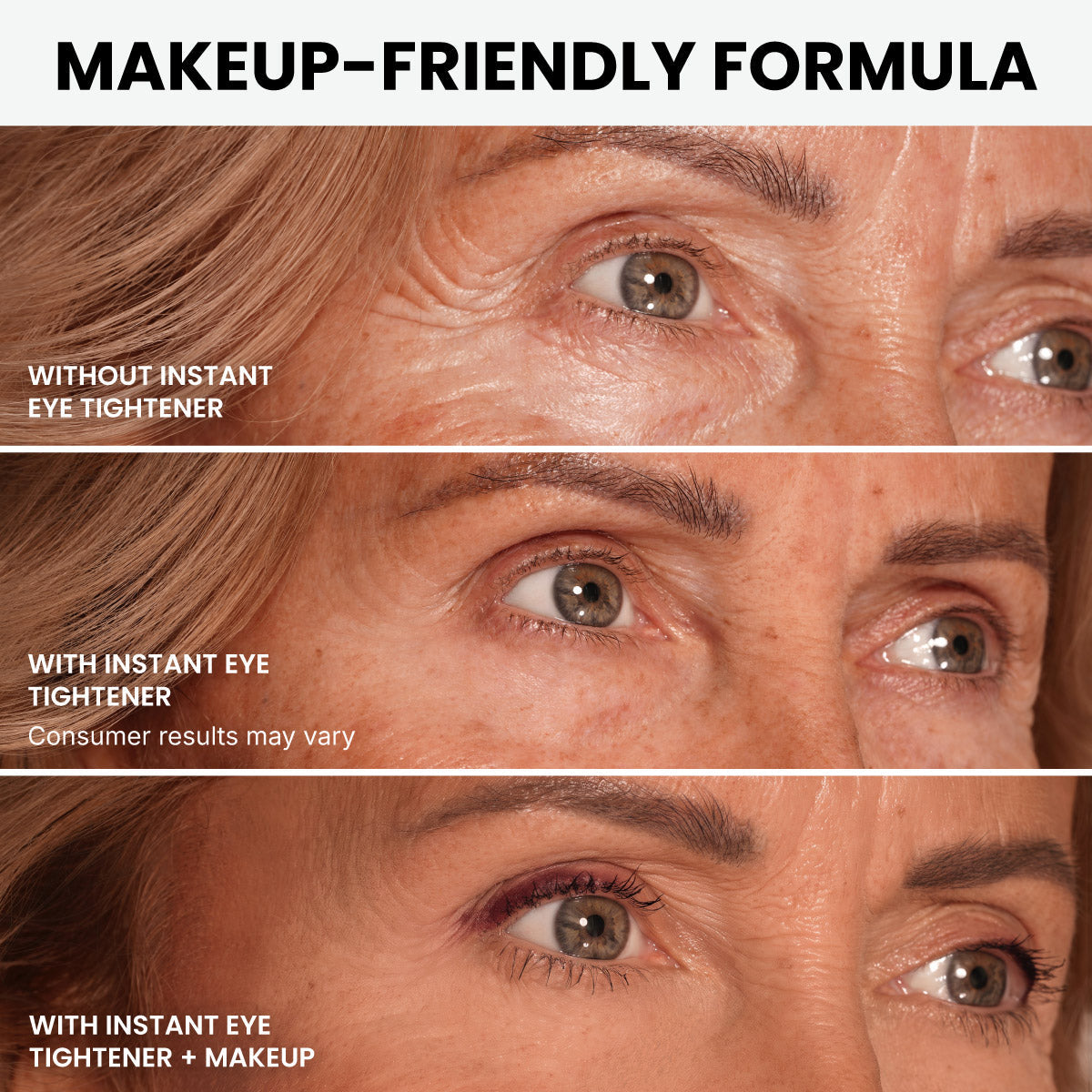 LIMETOW® Instant Eye Tightener