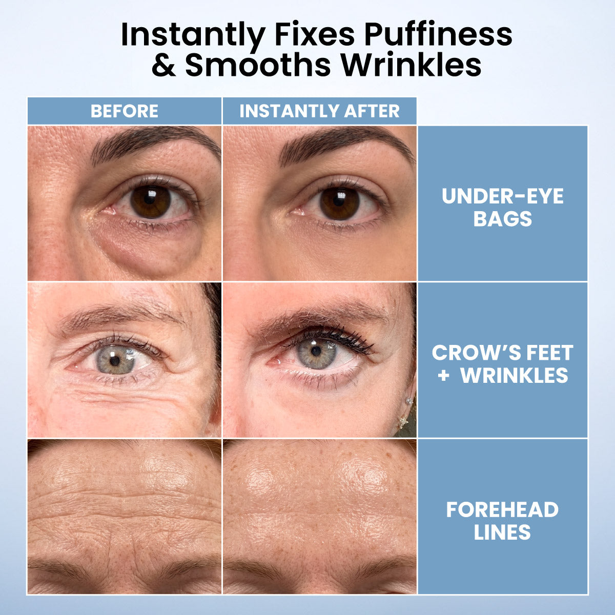 LIMETOW® Instant Eye Tightener