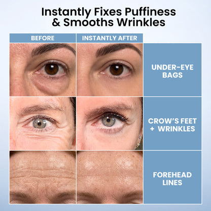 LIMETOW® Instant Eye Tightener